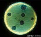 Photograph of Staphylococcus aureus cultured on an agar plate