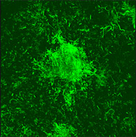 Biofilms are highly organized, densely populated communities complete with protective walls and a network of pipes that transport nutrients and dispose of wastes. Credit: E. Peter Greenberg