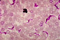 Trypanosoma brucei parasites (bright pink) surrounded by red blood cells (light pink) in a smear of infected blood. Courtesy of the Centers for Disease Control and Prevention/Dr. Mae Melvin