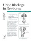 Urine Blockage In Newborns