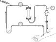 Diagram of a hemodialysis circuit.