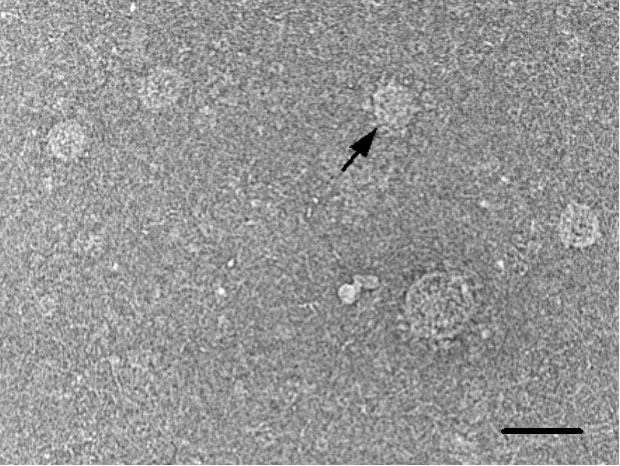 Electron microscopy of hepatitis C particles (arrow) purified by sucrose gradient centrifugation. Bar represents 100nm. Heller et al. Proc Natl Acad Sci U S A (102): 2579-83 , 2005.