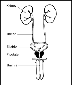 Front view diagram of male urinary tract showing normal urine flow from the kidneys through the ureters to the bladder.  Urine then passes out of the body through the urethra, which is surrounded by the prostate.