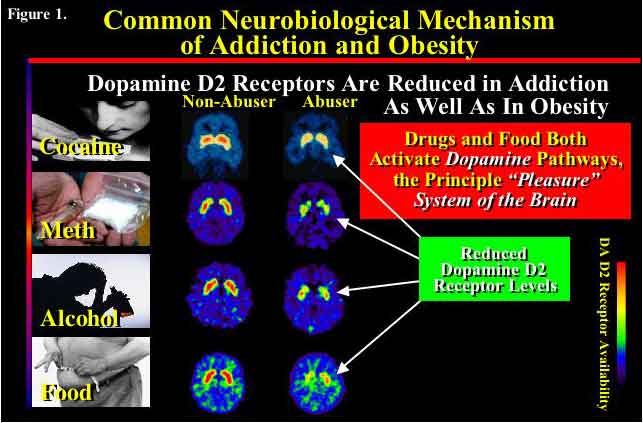 slide showing similar reduction in dopamine levels among drug users and obese individuals - in text