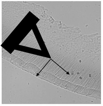 A set of measurements on the tectorial membrane.