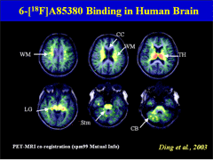Link - to powerpoint presentation: Imaging the Alpha4/Beta2 nAChR in the Human Brain