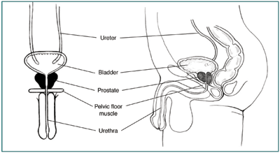 Front and side views of male urinary tract with labels to kidney, ureter, bladder, prostate, pelvic floor muscle, and urethra.