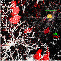 small neuron in adult rat neocortex that appears to have arisen from precursor cell, also visible in image