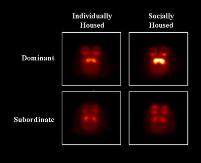 Brain Images of Monkeys Housed Individually and After Transfer to Social Housing
