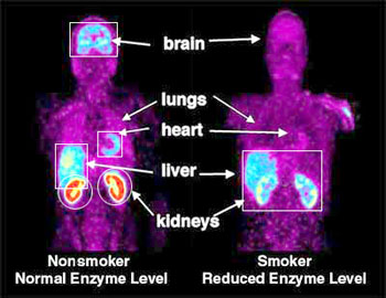 Smoking Decreases Enzyme in Peripheral Organs of Smokers