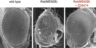Flies with a mutation in the RET oncogene, which leads to medullary thyroid cancer in humans, develop rough, non-functional eyes (middle). Treatment with the drug ZD6474, which targets RET, restored the eye cells to normal (right). A normal eye from a fly without the RET mutation is shown on the left for comparison.