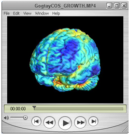 White matter growth in COS