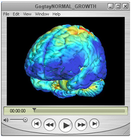 White matter growth in healthy controls