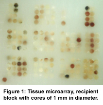 Figure 1: Tissue microarray, recipient block with cores of 1mm in diameter