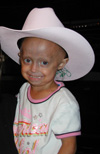 Megan, 5 (Progeria Patient)