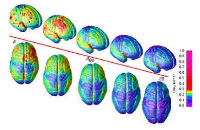 Time-lapse imaging tracks brain maturation from ages 5 to 20