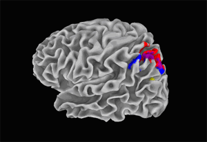 3-D MRI scan rendering of the brain’s white matter