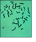 Image of 46 human chromosomes