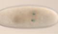 Fly embryo heart mutant image