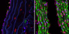 Blood Vessels in Progeria Mice