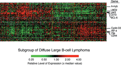 Subgroup of Diffuse Large B-cell Lymphoma