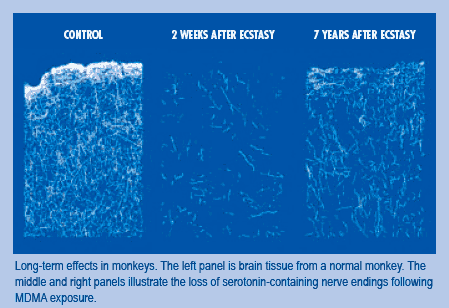 Serotonin Present in Cerebral Cortex Neurons