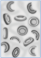 Drawing of broken red blood cells, as seen in the blood of people with hemolytic uremic syndrome.