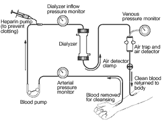 Illustration of a dialyzer.