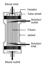 Illustration of a hollow fiber dialyzer.