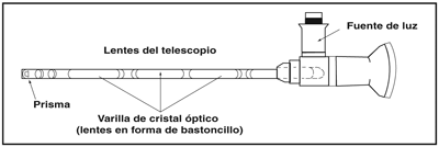 Imagen de un citoscopio con sus partes descritas.