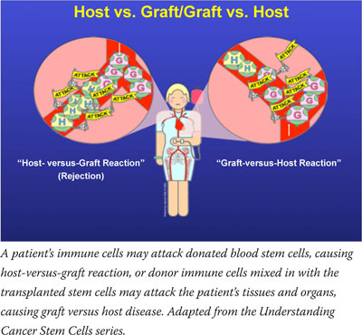 Host vs. Graft/Graft vs. Host: A patient's immune cells may attack donated blood stem cells, causing host-versus-graft reaction, or donor immune cells mixed in with the transplanted stem cells may attack the patient's tissues and organs, causing graft versus host disease. Adapted from the Understanding Cancer Stem Cells series.