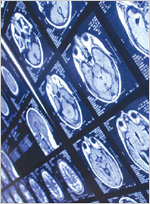 Photo of MRI brain scans