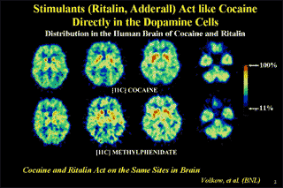 PET scan showing that cocaine and methylphenidate act on the samek sites in the brain 