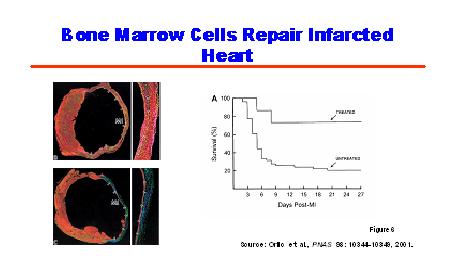 Bone Marrow Cells Repair Infarcted Heart