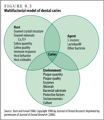Multifactorial model of dental caries