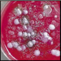 Photograph of anthrax.