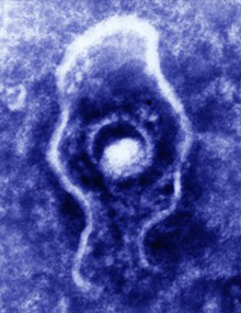 a microscopic image of the herpes virus.