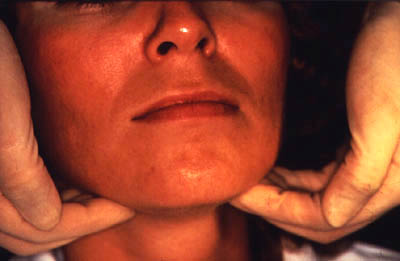 Photograph of dentist examining the face