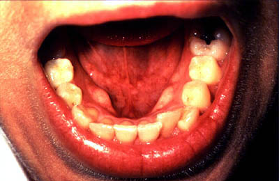 Photograph of examination of floor of mouth