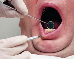 dental exam