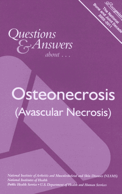 Osteonecrosis (Avascular Necrosis), Questions and Answers about cover