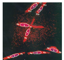 Fibroblast cells stained with fluorescent dye.
