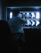 Caucasian female radiologist points to one of several breast X-rays displayed on a large light box in front of her.