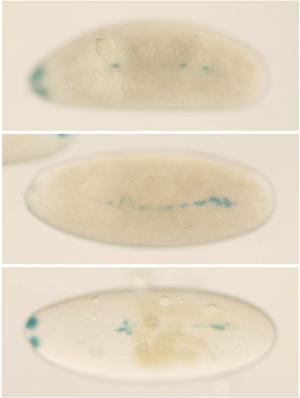 Fly embryo images showing heart phenotype mutation