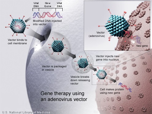 A new gene is injected into an adenovirus vector, which is used to introduce the modified DNA into a human cell. If the treatment is successful, the new gene will make a functional protein.