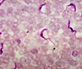 A micrograph of a rat blood smear revealing Trypanosoma brucei parasites. Infected tsetse flies spread trypanosome parasites to humans, causing African trypanosomiasis, or sleeping sickness.