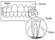 Drawing of teeth, gums, and a single tooth.