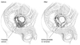 Drawings of the male urinary tract. The left drawing, labeled 