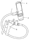 Drawing of a vacuum-constrictor device placed around the penis. Pictured here are the necessary components: (a) a plastic cylinder, which covers the penis; (b) a pump, which draws air out of the cylinder; (c) an elastic ring, which, when fitted over the base of the penis, traps the blood and sustains the erection after the cylinder is removed.