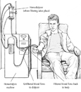Drawing of teenage boy receiving hemodialysis treatment. Labels point to the hemodialyzer, where filtering takes place; hemodialysis machine; a tube where unfiltered blood flows to the dialyzer; and a tube where filtered blood flows back to the patient.